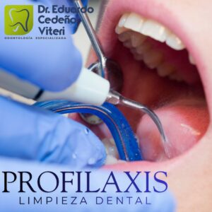 Limpieza Dental Profunda y Desmanchado. Descuentos y Beneficios, según formas de pago