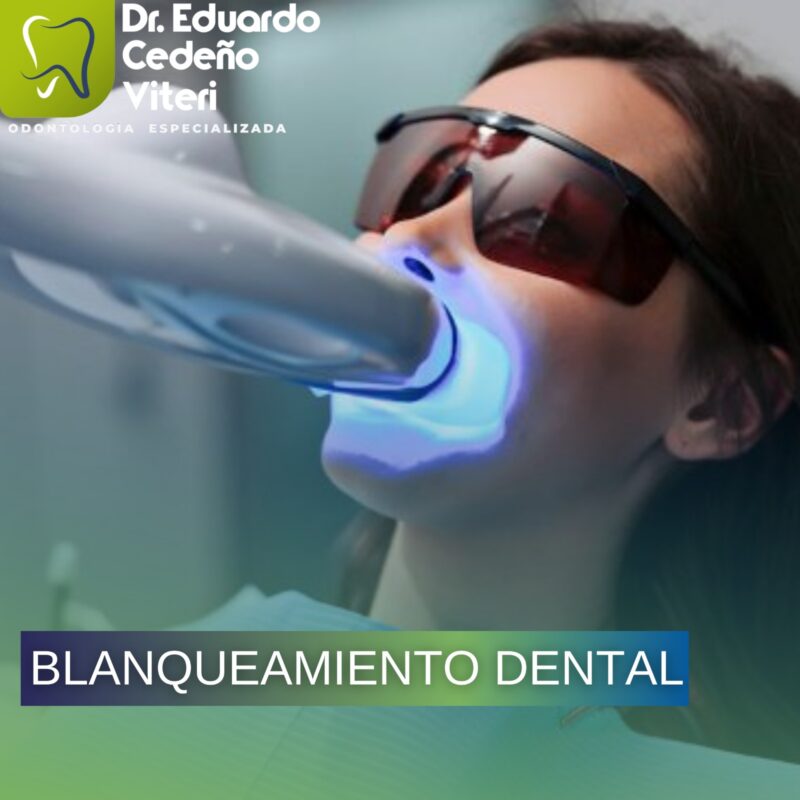 Blanqueamiento Con Luz LED