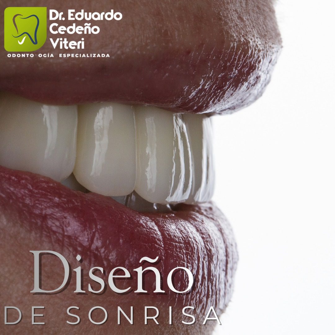Renueva Tu Sonrisa