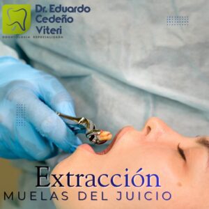 adiós dolor por muelas del juicio