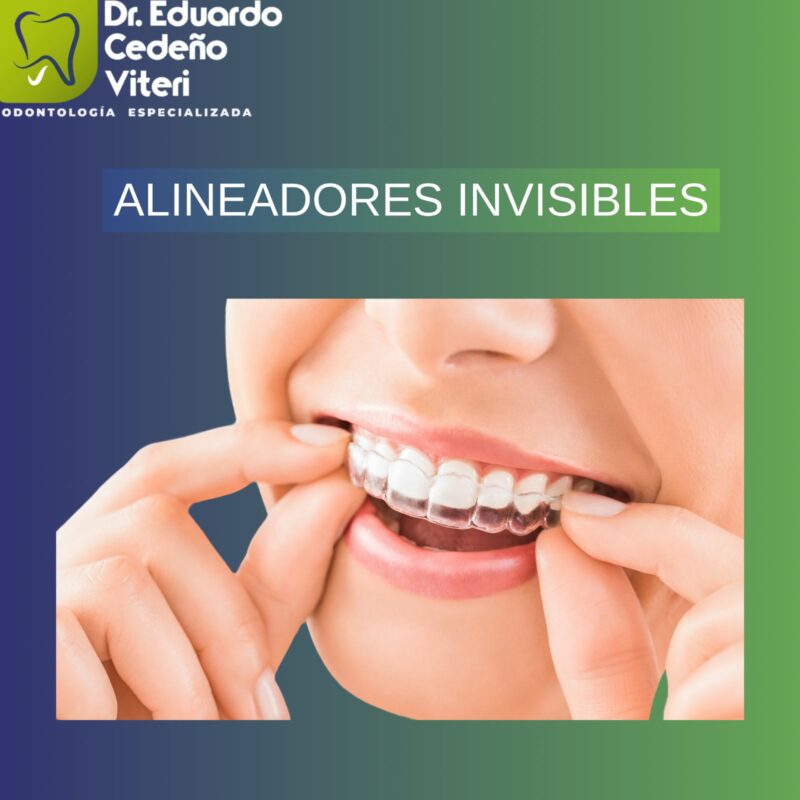 Alineadores invisibles