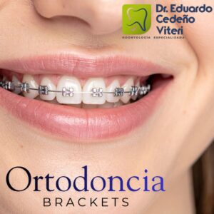Ortodoncia para todas las edades