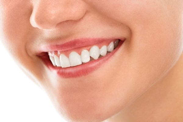 DISENO-SONRISA DISENO-SONRISA
