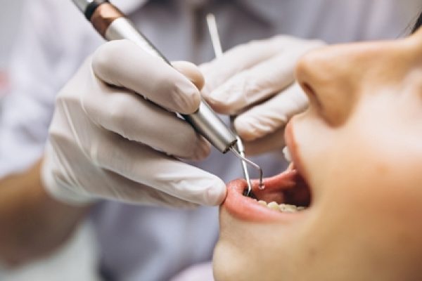 ENDODONCIA ENDODONCIA